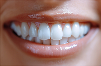 Dental Implant Transformation